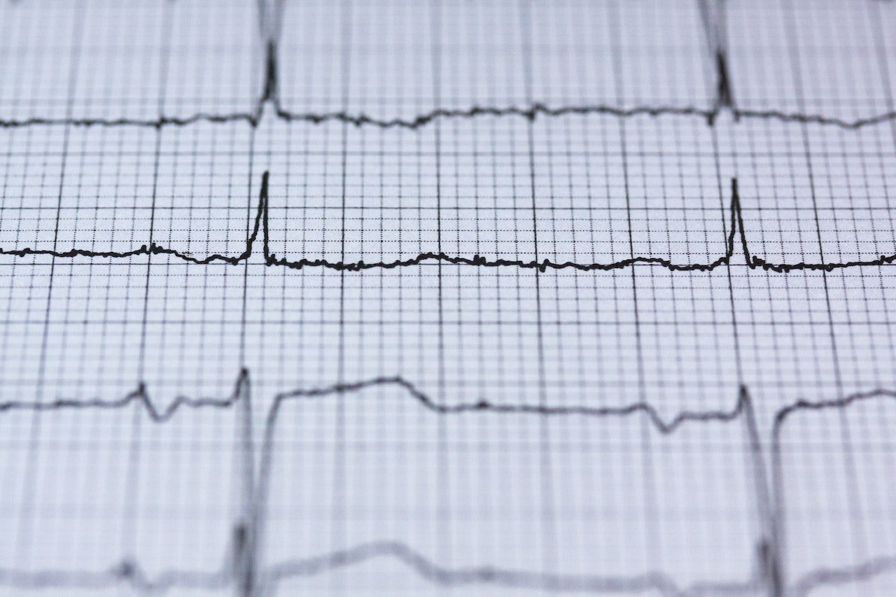 Czy najnowsze technologie pozwolą nam wyeliminować arytmię serca?